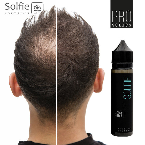 Solfie Hair Active Haarwachstumsserum - NEW FORMULA (50 ml)